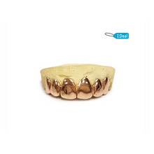 Load image into Gallery viewer, 10k-24k Yellow Gold + Platinum and Silver 1,2,4,6,8 Teeth Top And/Or Bottom
