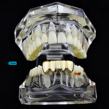 Load image into Gallery viewer, 10k-24k Yellow Gold + Platinum and Silver 1,2,4,6,8 Teeth Top And/Or Bottom
