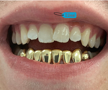 Load image into Gallery viewer, 10k-24k Yellow Gold + Platinum and Silver 1,2,4,6,8 Teeth Top And/Or Bottom

