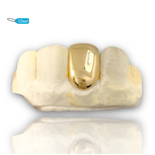 Load image into Gallery viewer, 10k-24k Yellow Gold + Platinum and Silver 1,2,4,6,8 Teeth Top And/Or Bottom
