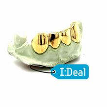 Load image into Gallery viewer, 10k-24k Yellow Gold + Platinum and Silver 1,2,4,6,8 Teeth Top And/Or Bottom
